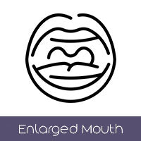 Enlarged Mouth Size (+$105 AUD)