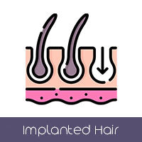 Implanted Synthetic Hair (+$120 AUD)