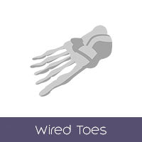 Wired Toes (+$60 AUD)