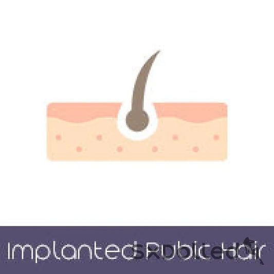 Implanted Pubic Hair (+150 AUD) | StarPery | SxDolled.