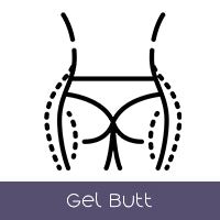 Gel Butt (+$95 USD) - SxDolled -